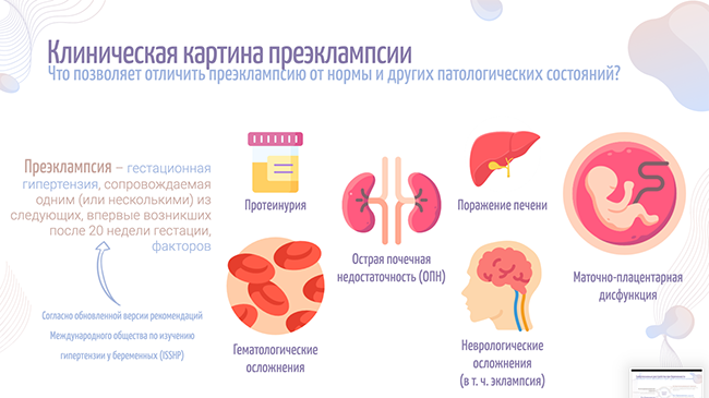 клиническая картина преэксламсии